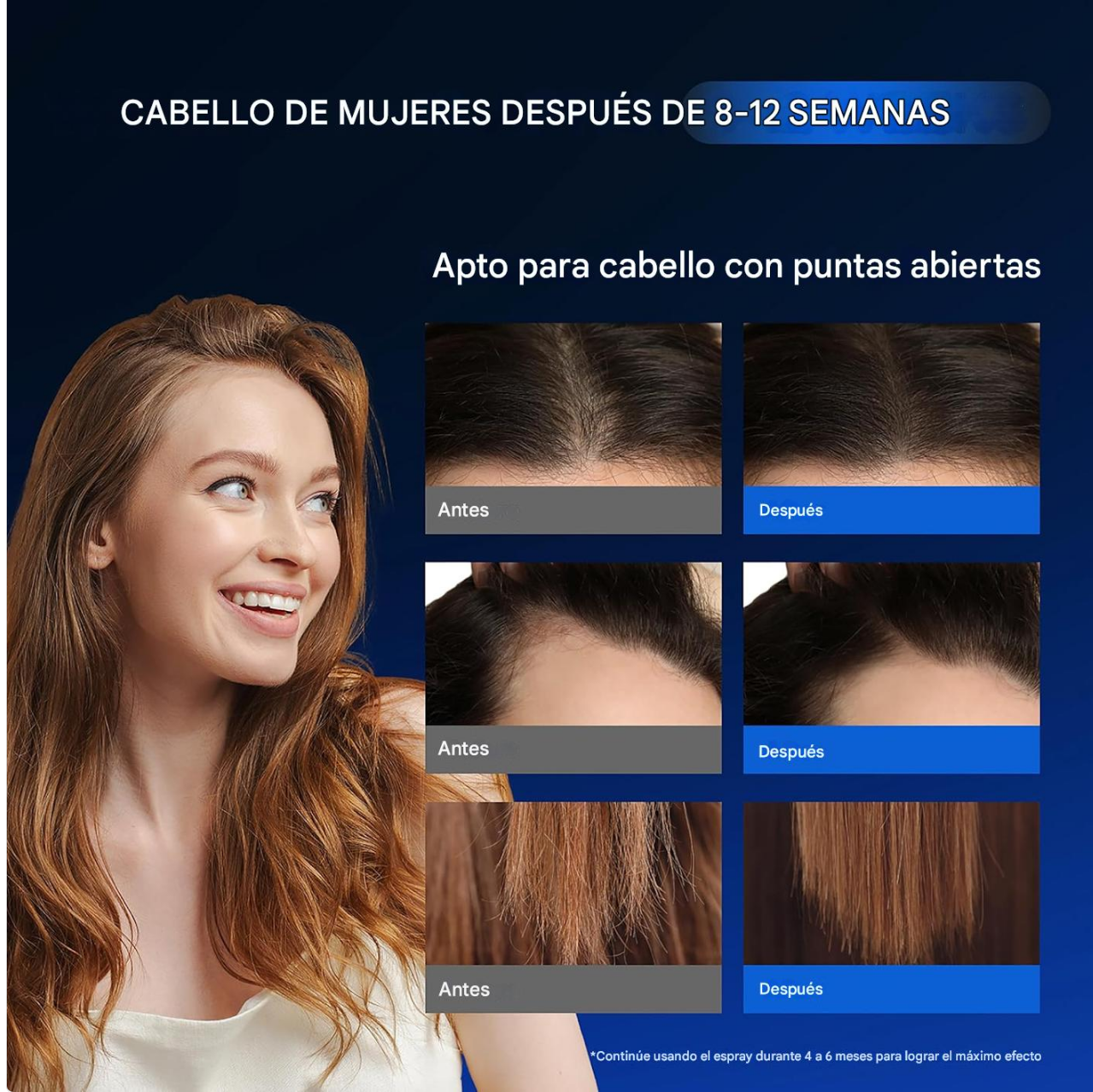 MINOXIDIL CON BIOTINA