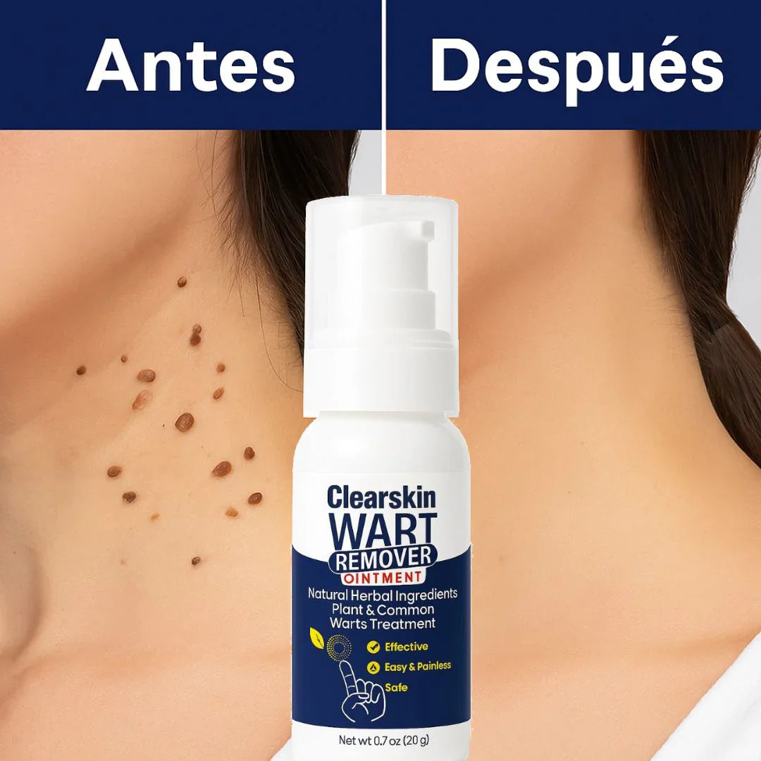 CLEARSKIN WART REMOVER elimina las verrugas