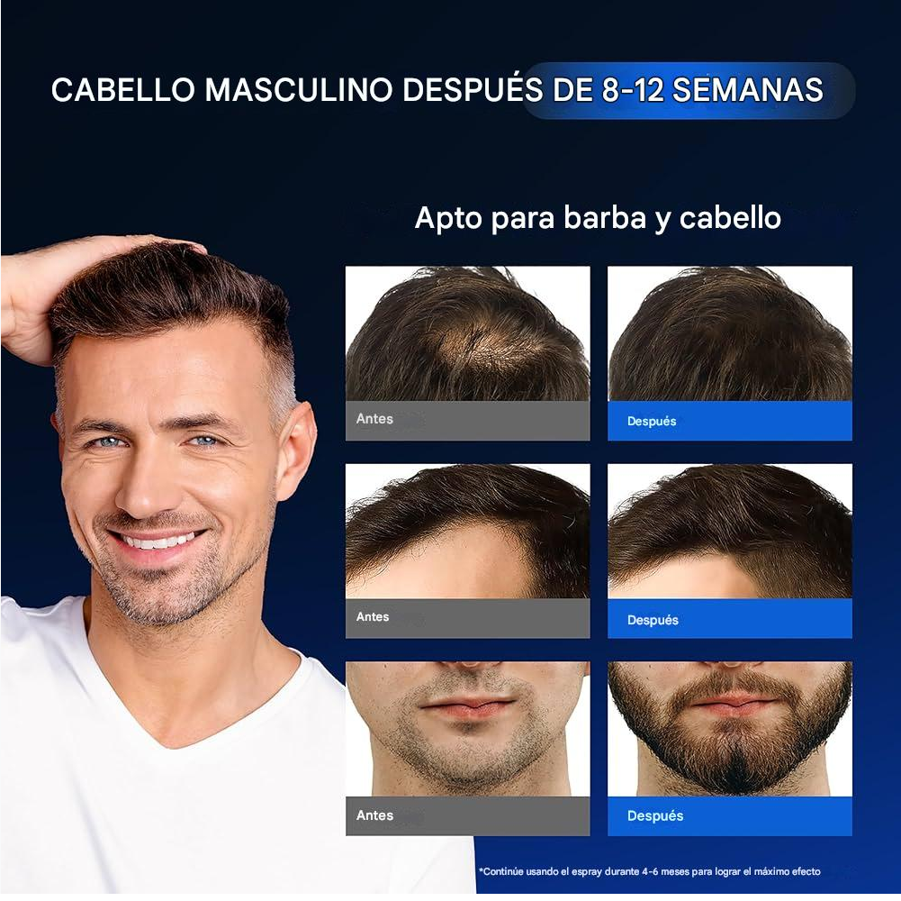 MINOXIDIL CON BIOTINA