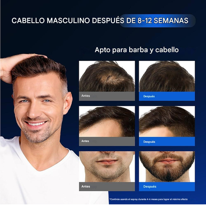 MINOXIDIL CON BIOTINA